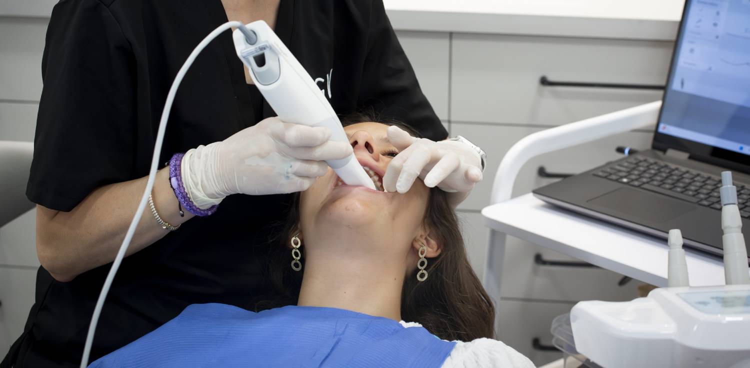 Escàner intraoral 3D